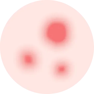 赤みタイプ